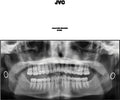 JVC 2LP by Jack Van Cleaf album artwork
