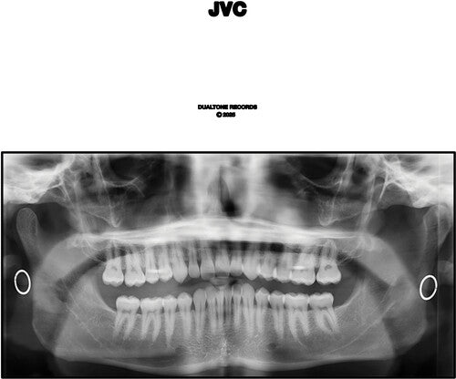 JVC 2LP by Jack Van Cleaf album artwork